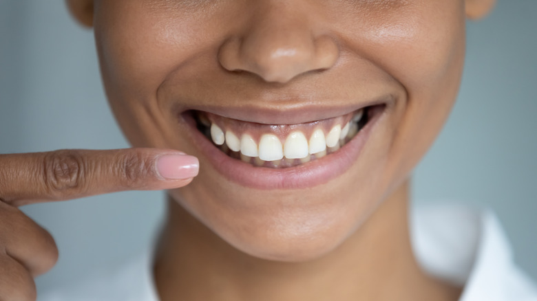 woman pointing at white teeth