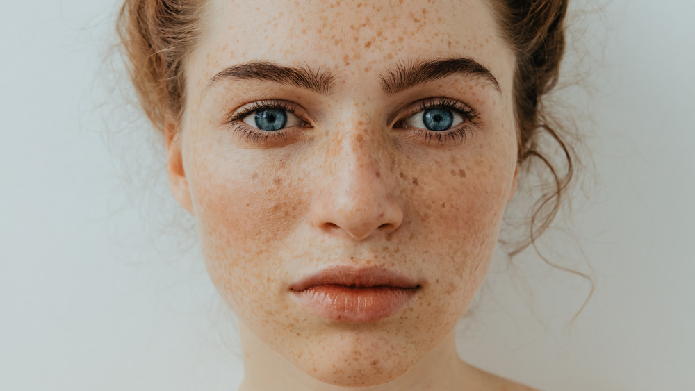 woman with freckles