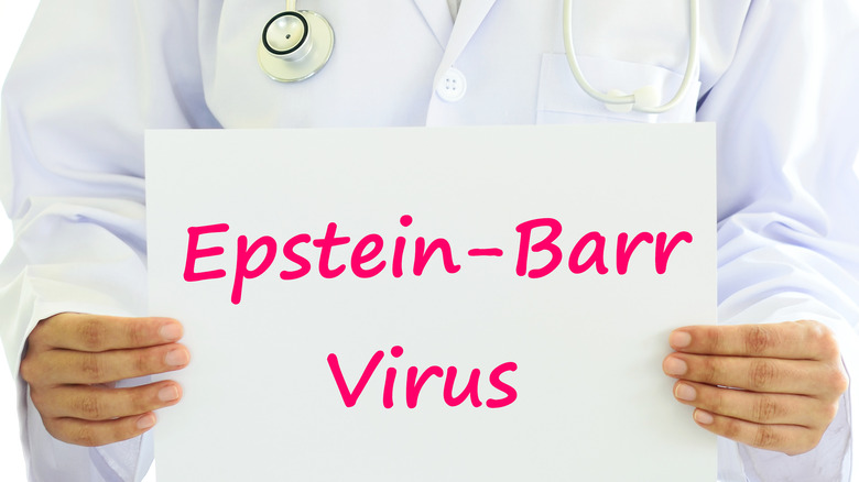 'Epstein-Barr Virus' written on doctor's card 