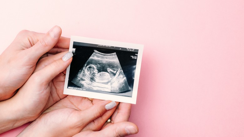 A pair of hands holding an ultrasound