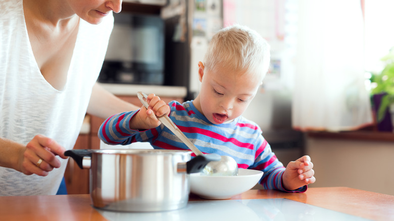 Child with cleft lip spooning out soup