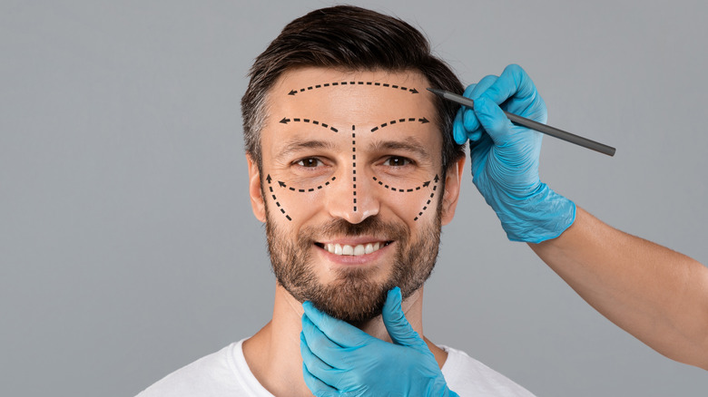 A man getting ready for plastic surgery
