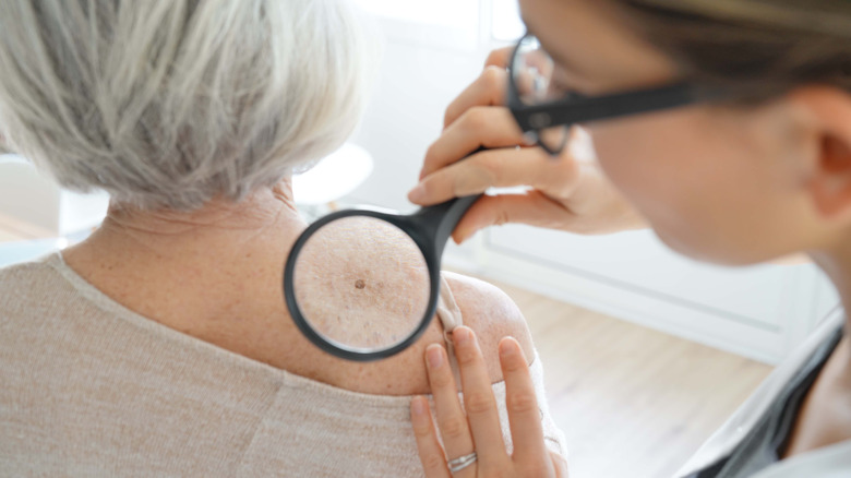 Doctor checking patient for skin cancer