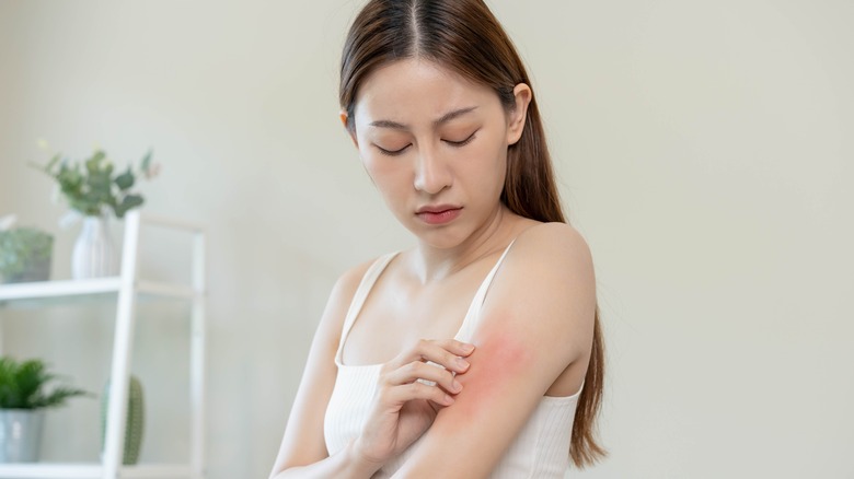 woman itching skin