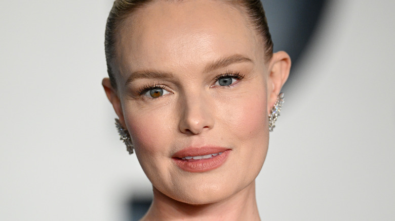 Kate Bosworth with heterochromia