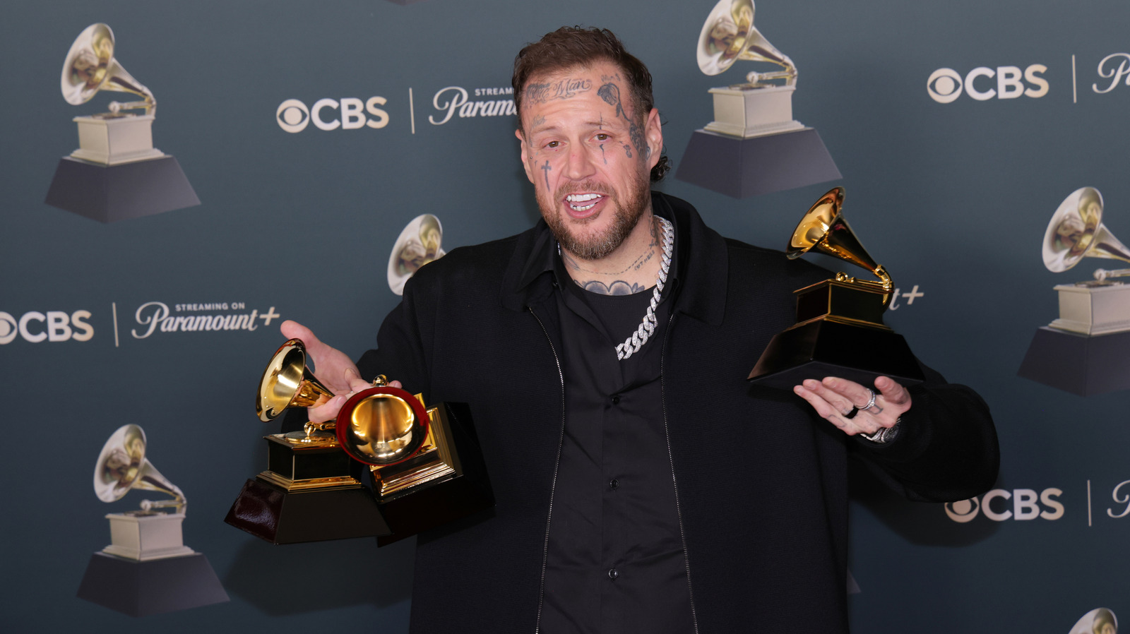 Reactions To Jelly Roll’s 300-Lb Weight Loss Prove We’re All Missing The Point