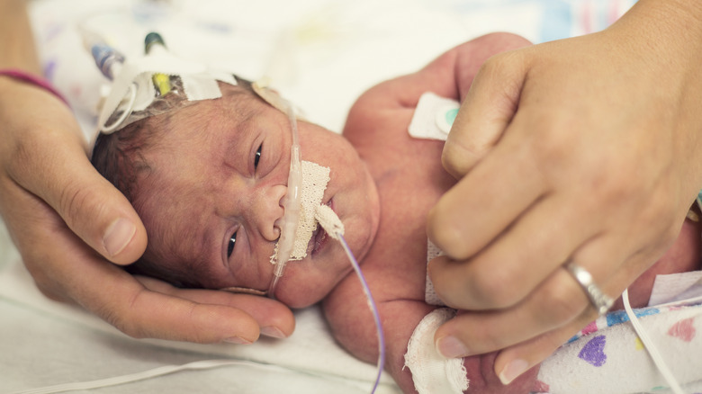 Premature baby in the NICU