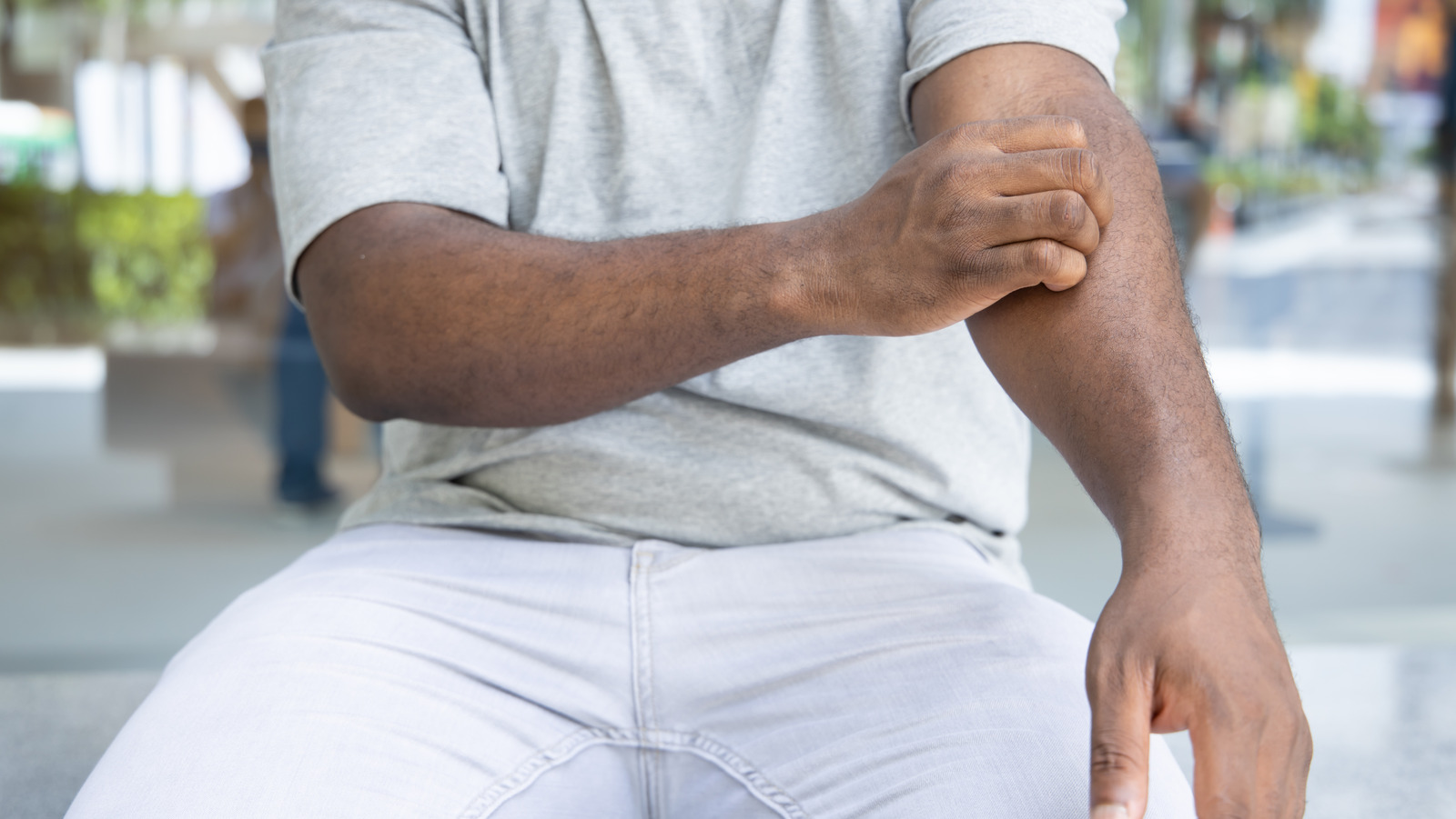 Ringworm Explained Causes, Symptoms, And Treatments