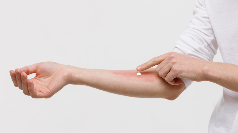 Applying ointment on arm