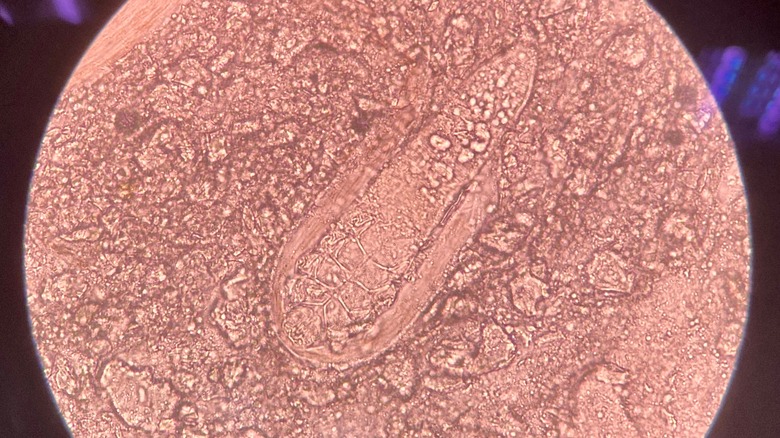 Demodex under microscope