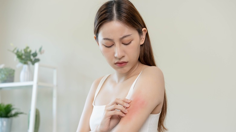 woman itching skin