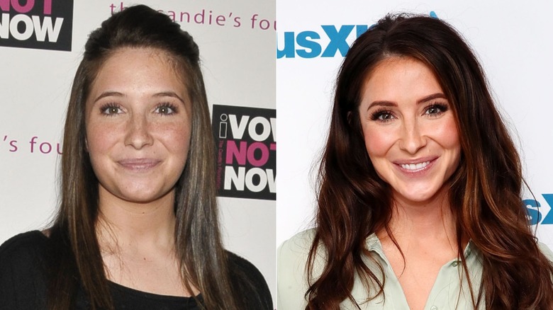 Bristol Palin before and after her jaw surgery