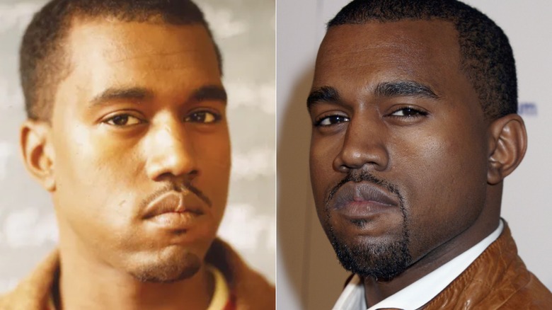 Kanye West (Ye) when he was younger and when he was older after jaw surgery