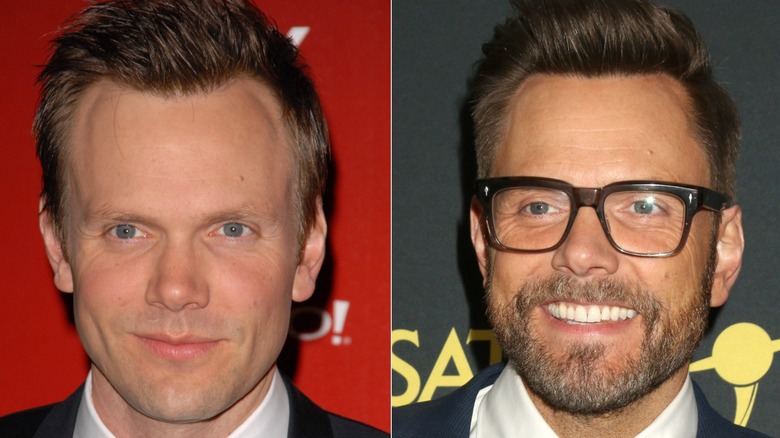 Joel McHale before and after four hair transplants