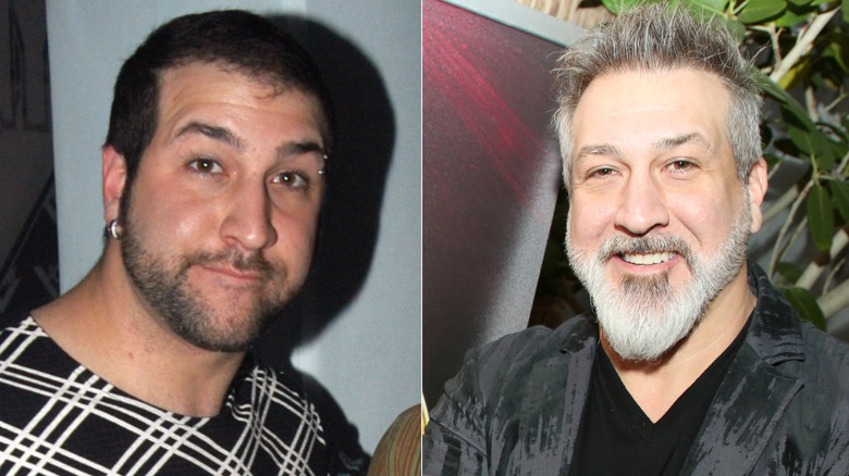 Joey Fatone when his hair was starting to thin and after undergoing hair treatment procedures
