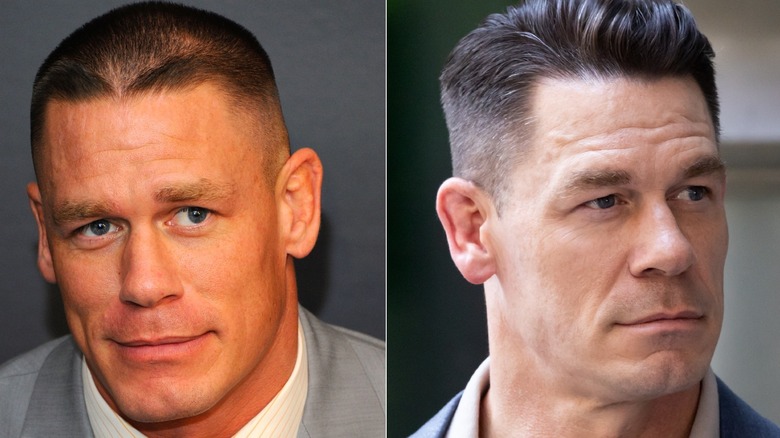 John Cena before and after getting hair restoration procedures