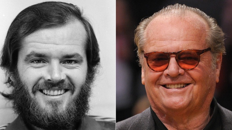 Side-by-side photos showing Jack Nicholson's hair loss