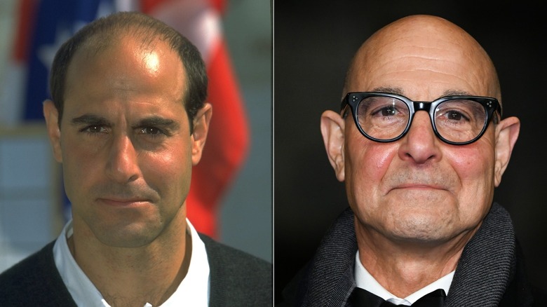 Side-by-side photos showing Stanley Tucci's hair loss