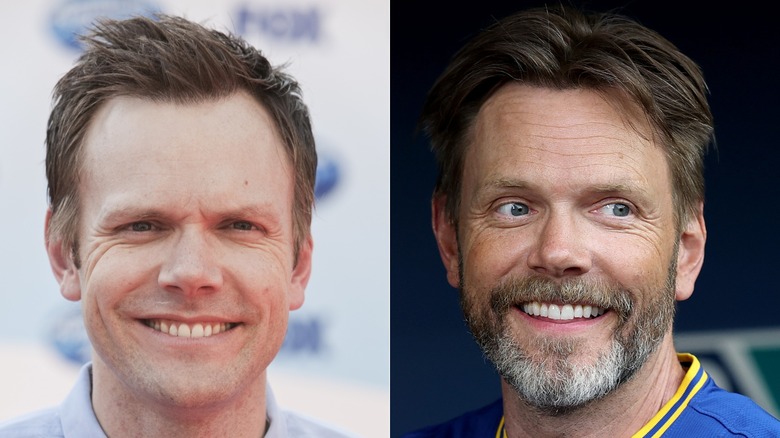 images of Joel McHale before and after his hair transplants