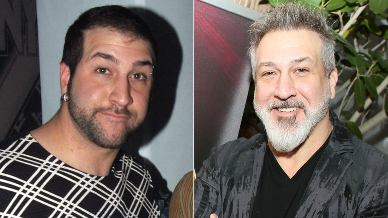 Joey Fatone when his hair was starting to thin and after undergoing hair treatment procedures