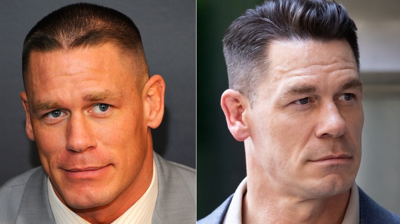 John Cena before and after getting hair restoration procedures