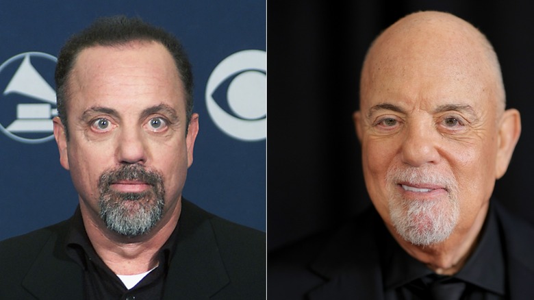 Side-by-side photos showing Billy Joel's hair loss