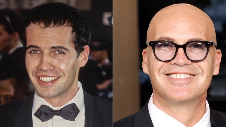 Side-by-side photos showing Billy Zane's hair loss