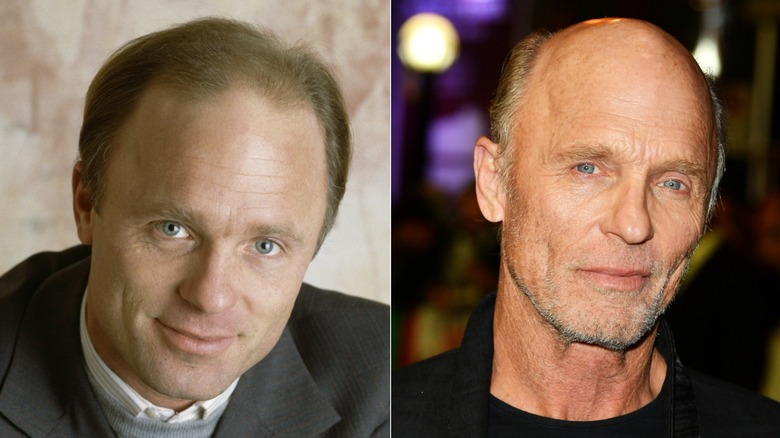 Side-by-side photos showing Ed Harris' hair loss