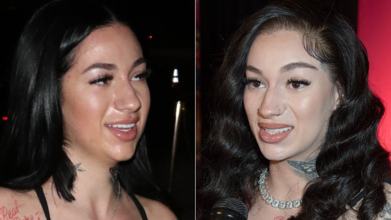 Bhad Bhabie before and after getting her fillers removed