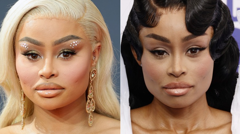 Blac Chyna before and after dissolving her facial fillers