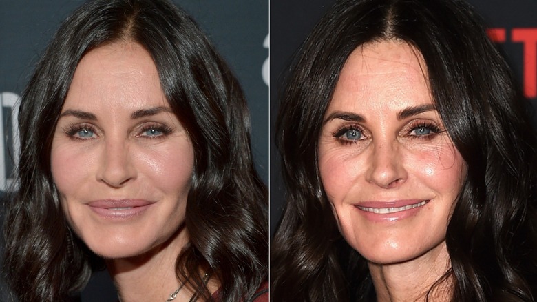 Courteney Cox before and after she decided to remove her facial fillers