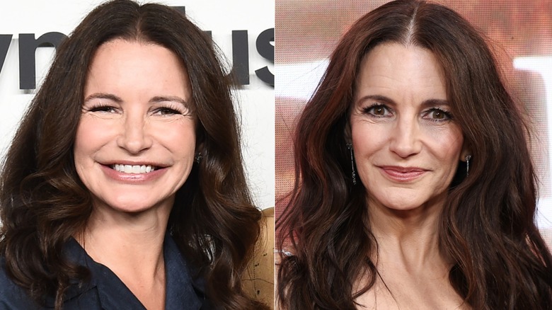 Kristin Davis before and after she dissolved her face filler