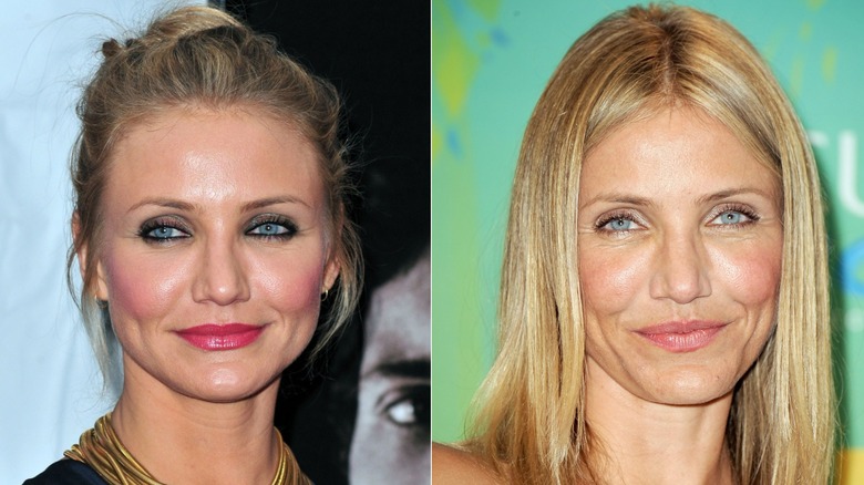Side-by-side photos showing Cameron Diaz before and after using Botox