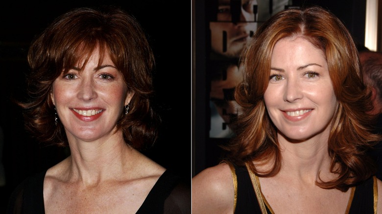 Side-by-side photos showing Dana Delany before and after using Botox