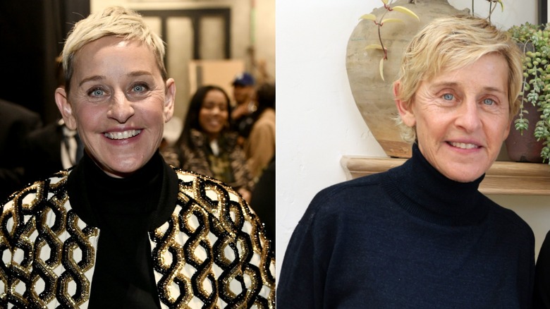 Side-by-side photos showing Ellen DeGeneres before and after using Botox