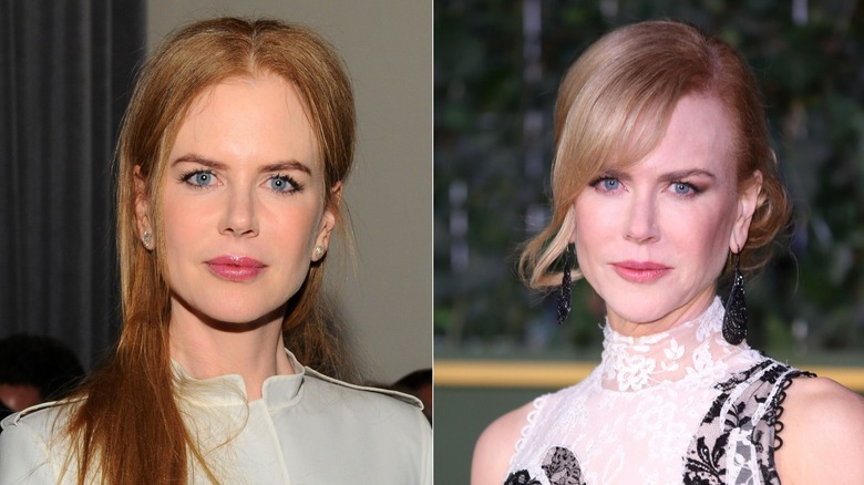 Side-by-side photos showing Nicole Kidman before and after using Botox