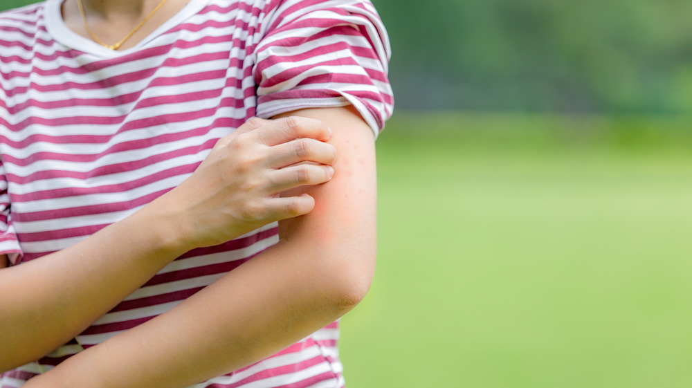 person with red spot on arm