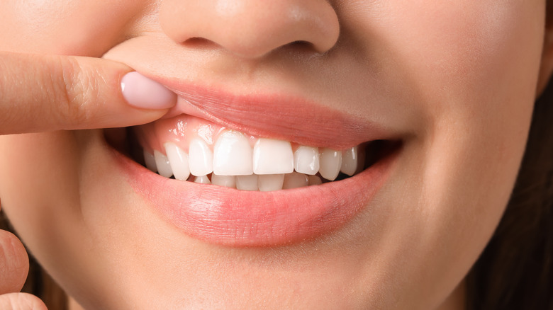 Clean teeth