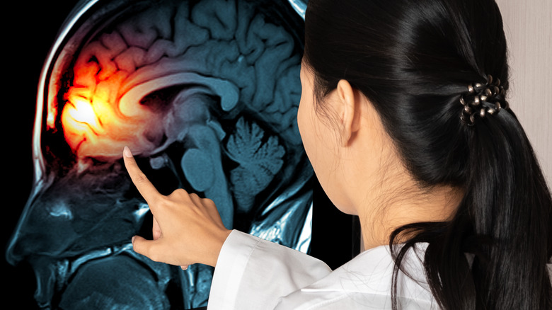 Doctor touching monitor with brain image