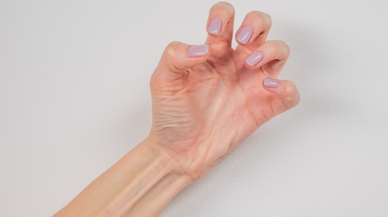 Rigid female hand during seizure