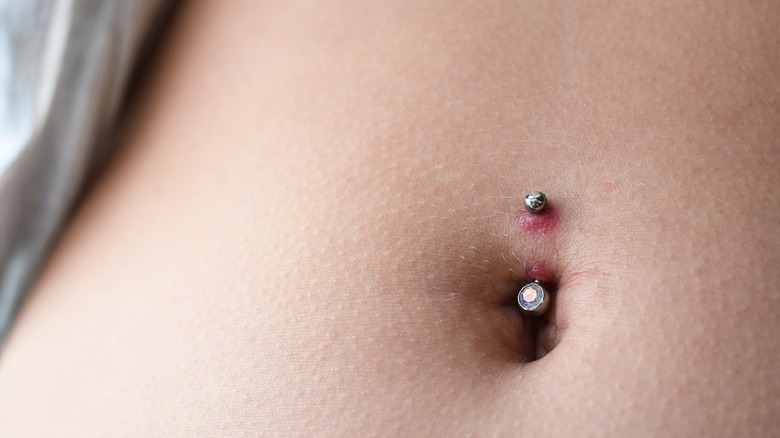 Red inflamed belly button piercing