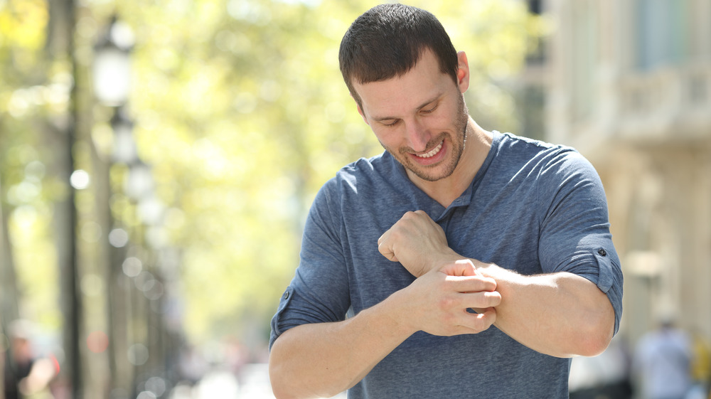 man scratching arm