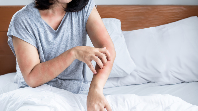 A woman in bed sitting up and scratching her arm