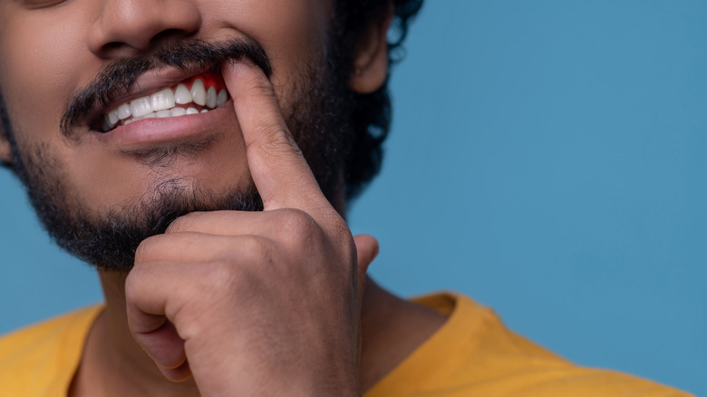 Man showing inflamed gumline