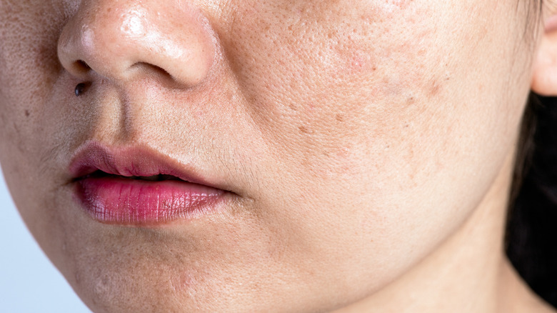 woman skin face