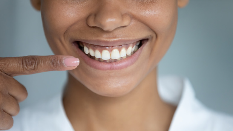 Smiling woman pointing to front teeth