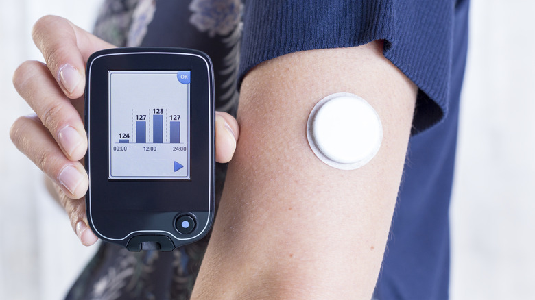 continuous glucose monitor on woman's arm