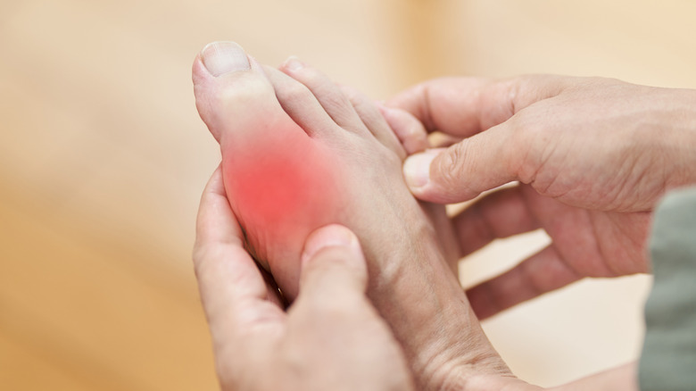 A man holding his foot showing symptoms of gout