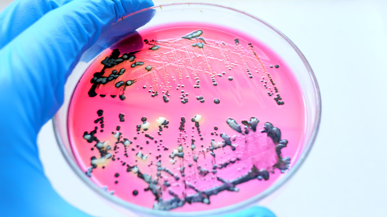 close up of the bacteria, Salmonella 