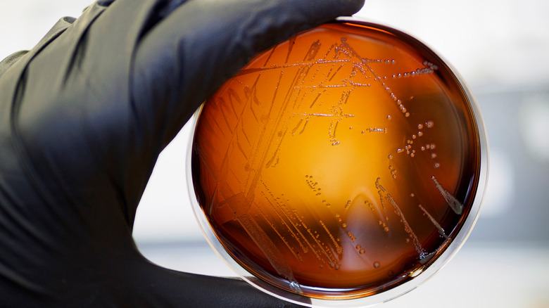 Listeria growing on a dish